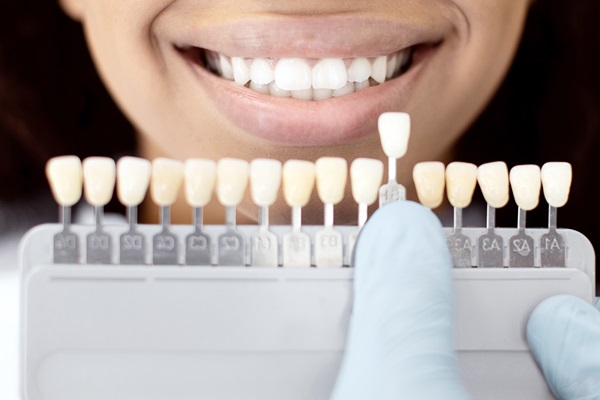 How Dental Bonding Can Restore Your Smile