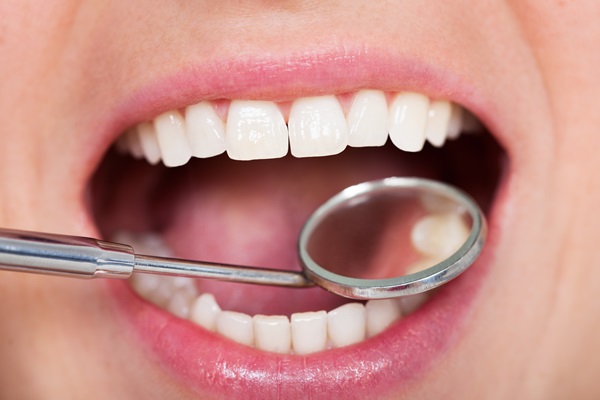 Prevent Further Tooth Decay With Dental Fillings