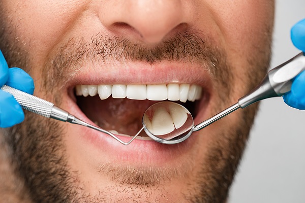 How A General Dentist Treats Tooth Decay