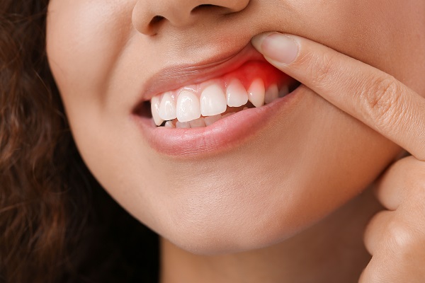 Routine Dental Checkups Can Help Prevent Gum Disease