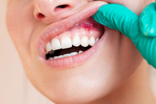 How Gum Disease Treatment Restores Oral Health And Confidence