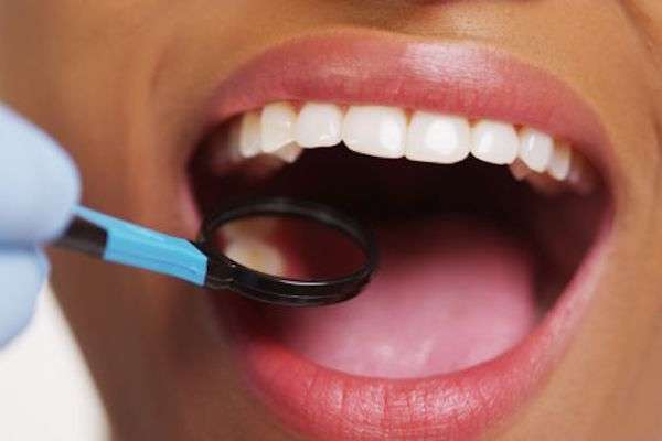 How a General Dentist Treats Cavities from All Smiles Dental Center in San Antonio, TX
