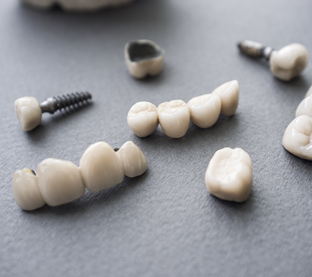 San Antonio The Difference Between Dental Implants and Mini Dental Implants