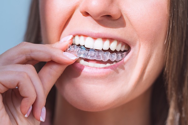 Can An Invisalign Dentist Correct Crooked Teeth?