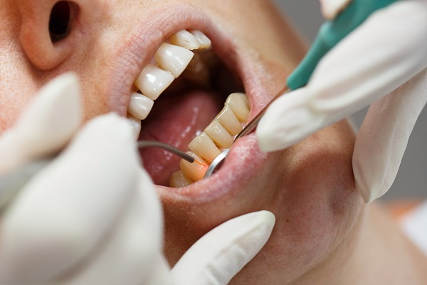 Laser Dentistry: An Alternative To Traditional Dental Treatment