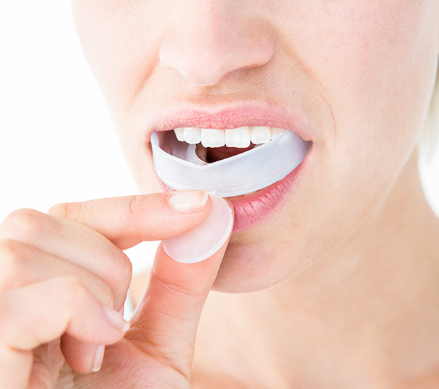 San Antonio Mouth Guards