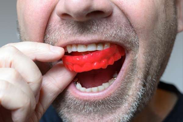 Save Your Teeth by Wearing Mouth Guards at Night from All Smiles Dental Center in San Antonio, TX