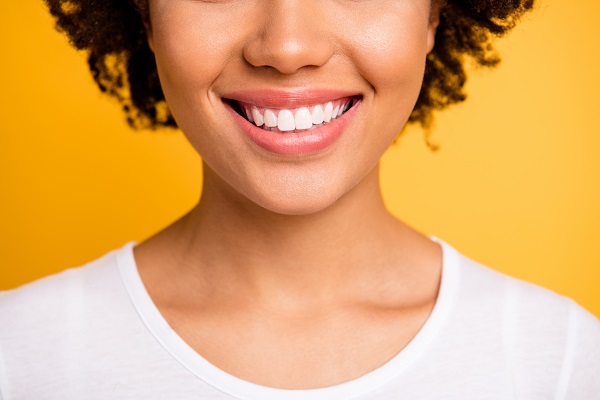 When You Should Get Dental Veneers Replaced