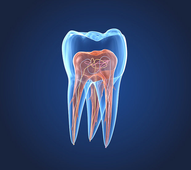 San Antonio What is an Endodontist