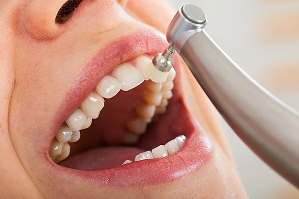 Why Is It Necessary to Get a Dental Cleaning? from All Smiles Dental Center in San Antonio, TX